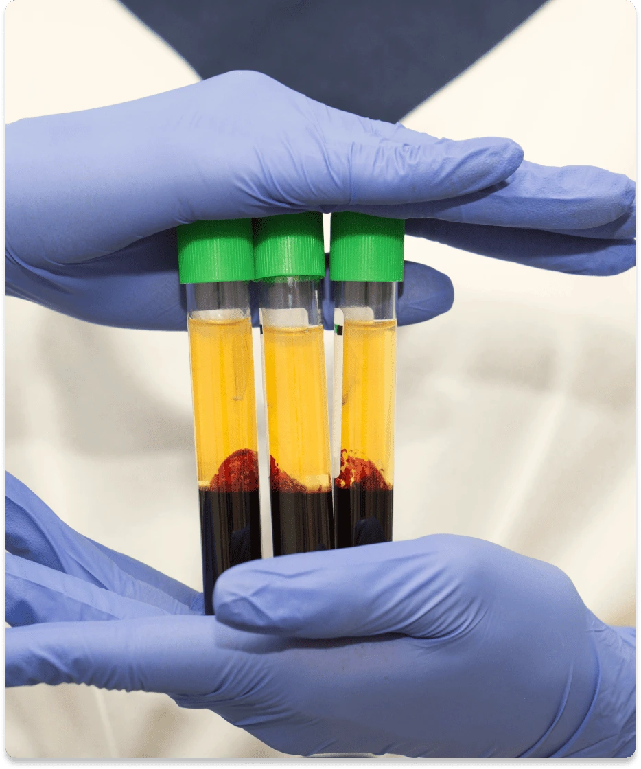 Regenerative medicine lab vials